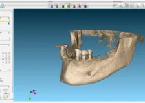 3shape scanner y su impacto en la odontología moderna