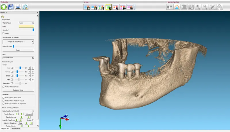 3shape scanner