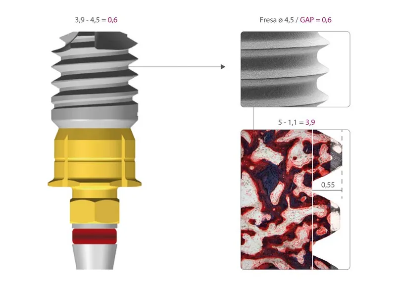 implantes klockner